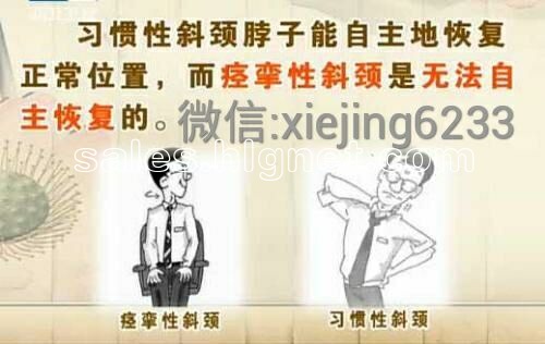 用“舒颈活络修复疗法”治疗痉挛性斜颈